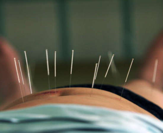 O acupunturista é responsável pela aplicação e manejo de agulhas no corpo do paciente, como forma de tratar dores e problemas de saúde localizados Foto: Getty Images O acupunturista é responsável pela aplicação e manejo de agulhas no corpo do paciente, como forma de tratar dores e problemas de saúde localizados Foto: Getty Images