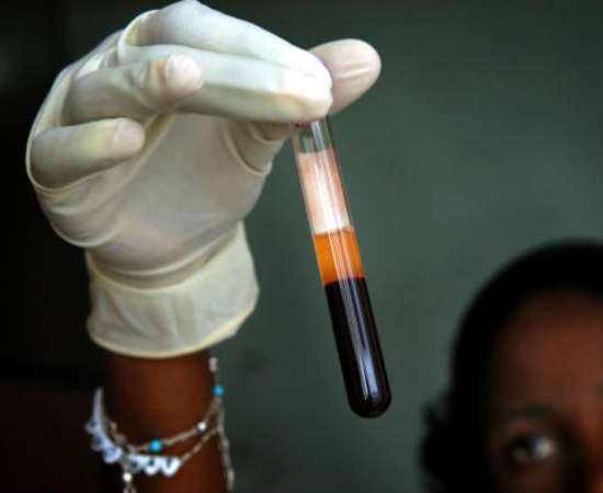 Esta é a área de estudo do sangue, seu uso terapêutico ou de seus componentes. Foto: Getty Images Esta é a área de estudo do sangue, seu uso terapêutico ou de seus componentes. Foto: Getty Images