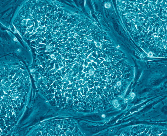 Foto: Nissim Benvenisty Foto: Nissim Benvenisty