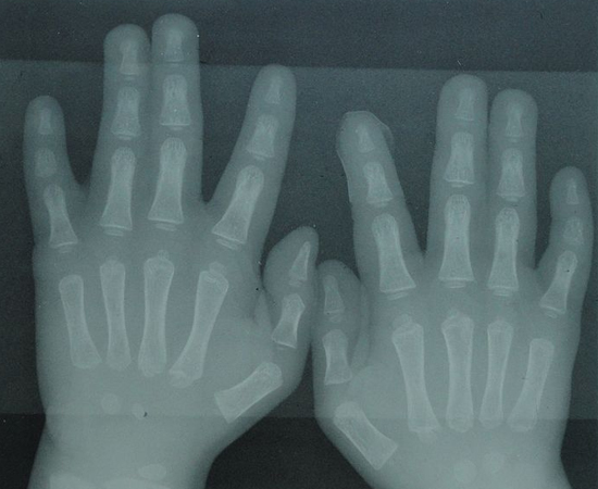 Foto: Kristoferb / Wikimedia Commons Foto: Kristoferb / Wikimedia Commons