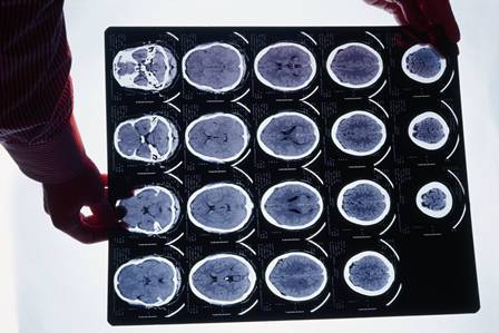 FMUSP inscreve para bolsa de pós-doutorado em Neurociência