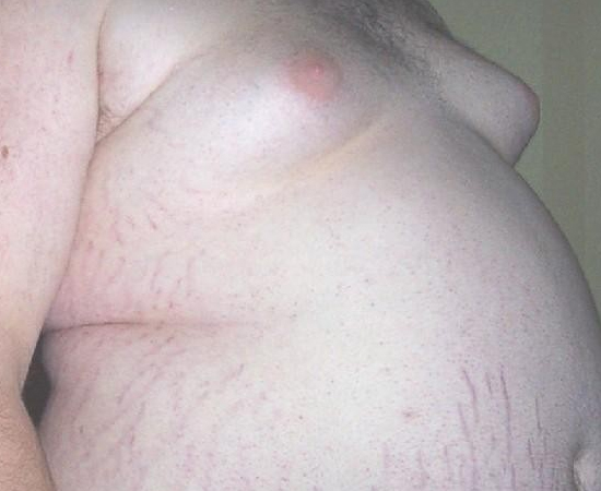 Foto: Wikimedia Commons Foto: Wikimedia Commons