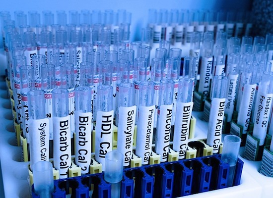 Com o tempo, o nível de anticorpos reduz até desaparecer. Por isso, o soro não impede novas infecções. (Foto: Creative Commons) Com o tempo, o nível de anticorpos reduz até desaparecer. Por isso, o soro não impede novas infecções. (Foto: Creative Commons)