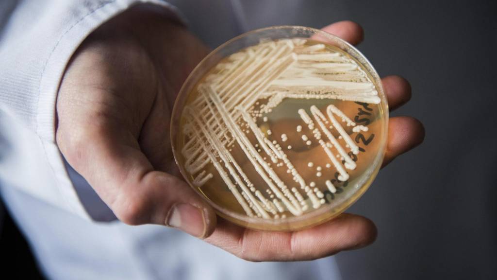 Candida auris Candida auris